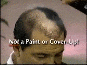 baldness spray.gif