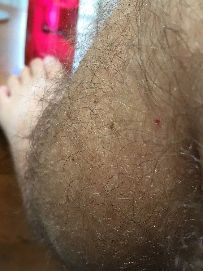 Leg Hair