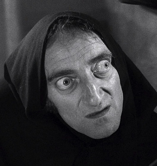 Marty-Feldman-1-