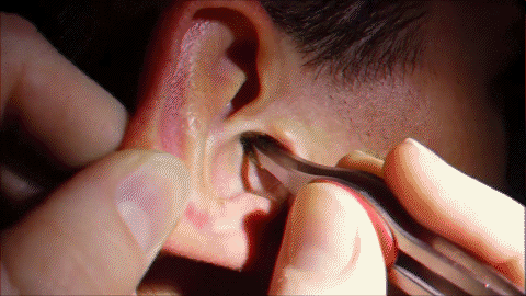 earwax.gif