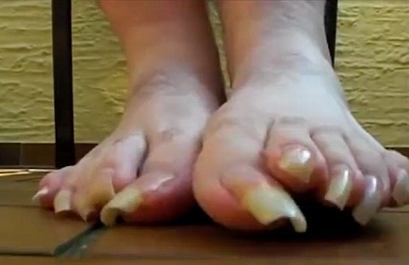 toenails long